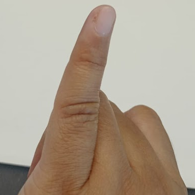 dry skin is the reason