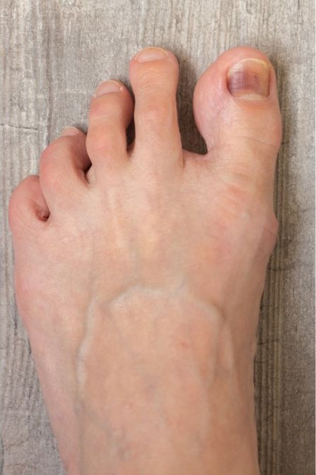 pic of foot