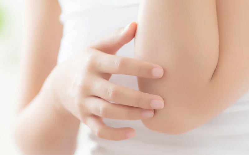 remove blackness from elbows at home
