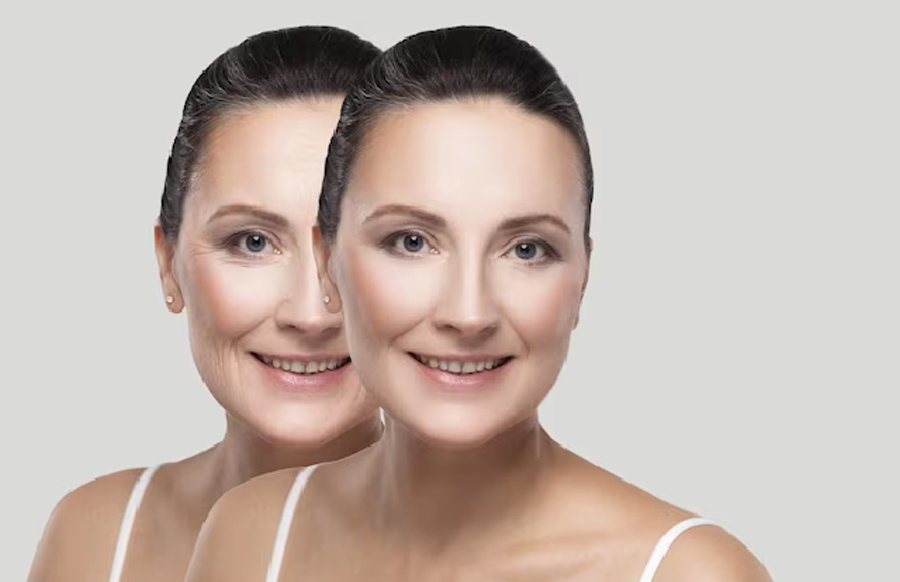 anti aging