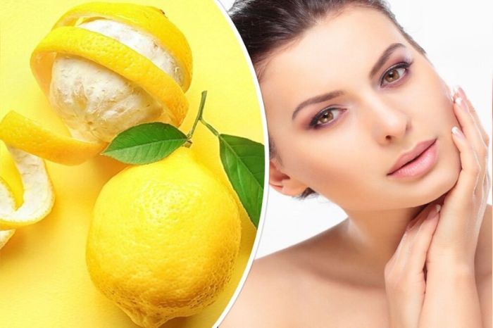 home remedies to get rid of acne black spots in one week