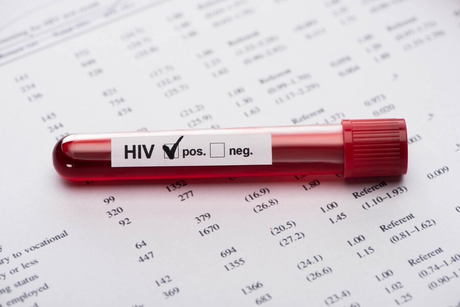 positive hiv blood sample test paper result form