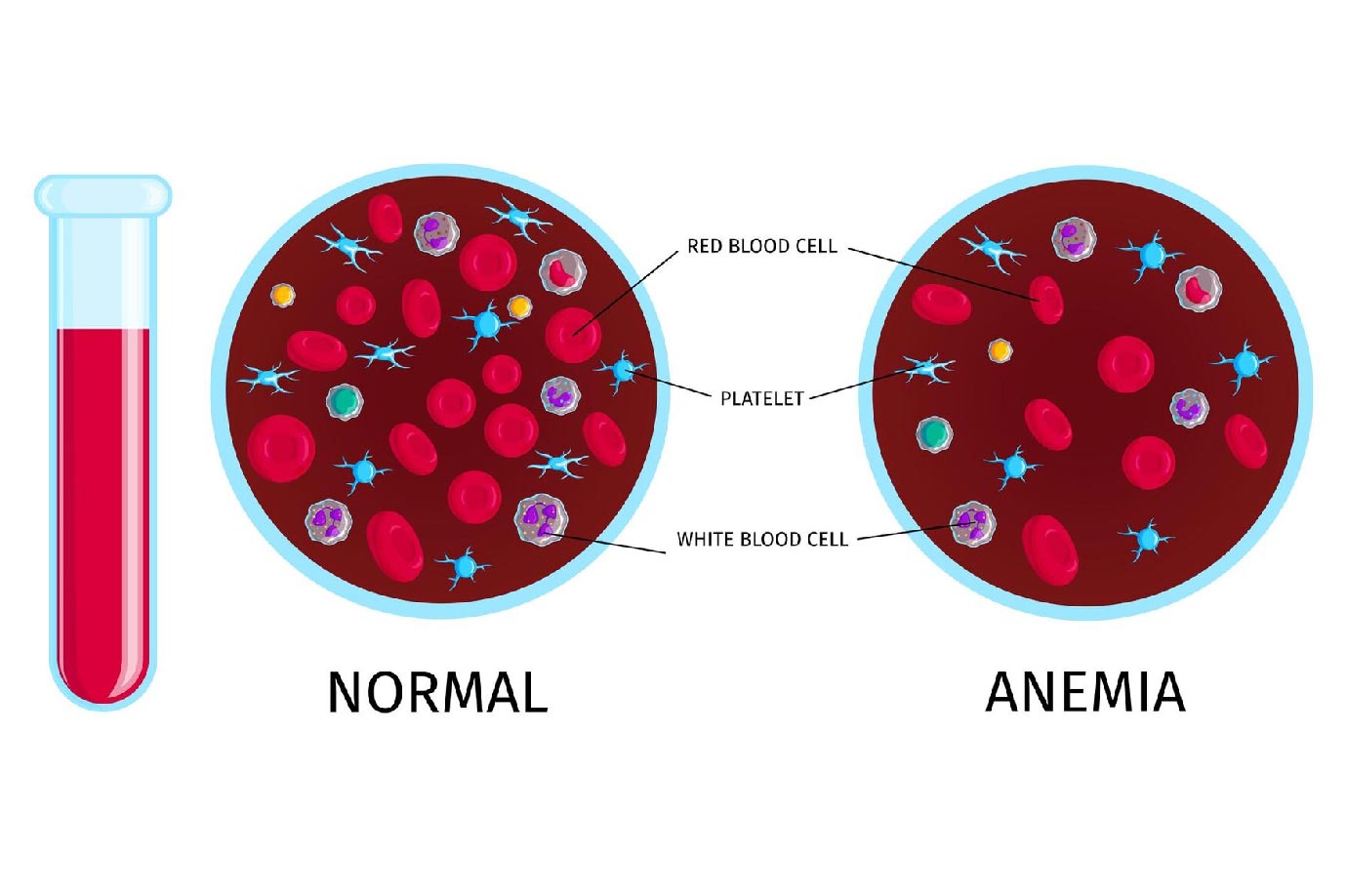diet plan for anemia
