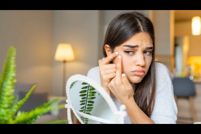 home remedies to remove blackheads naturally