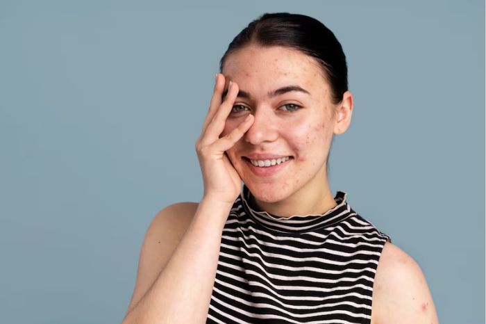 How to Use Sunscreen Moisturizer What Skin Experts Say