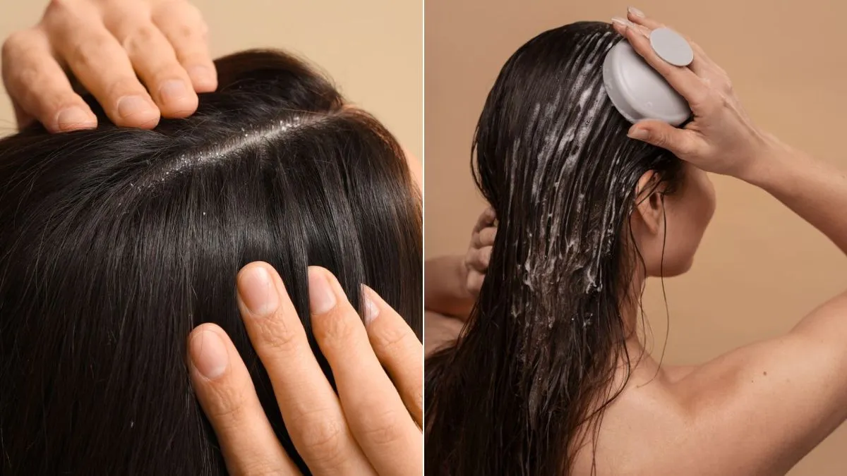 Ketoconazole and Zinc Pyrithione Shampoo
