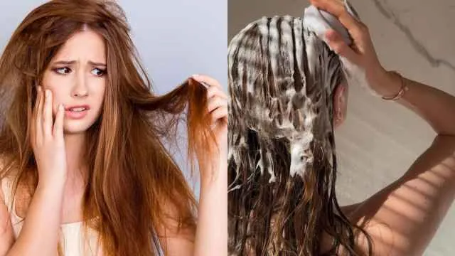 Dry Hair के लिए सही Shampoo कैसे चुनें? विकल्पों के साथ जानें