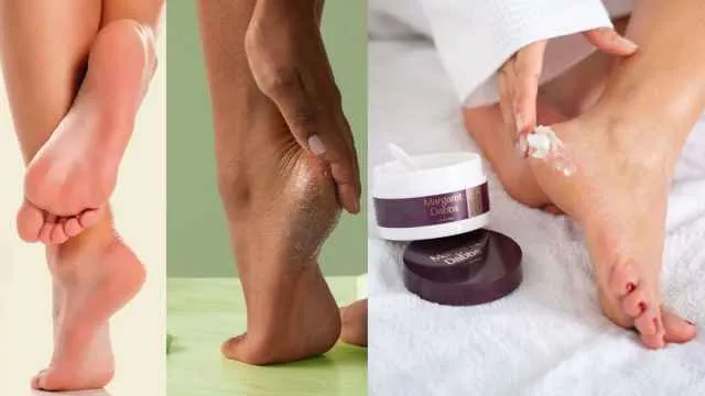5 बढ़िया Foot केयर Cream के साथ, फटी एड़ियों को कहें बाय-बाय!