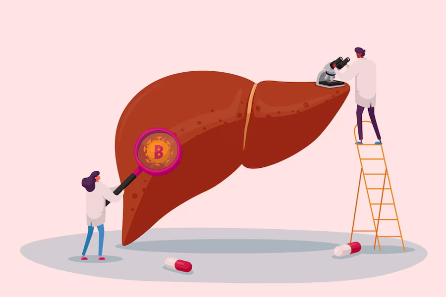 fatty liver treatment