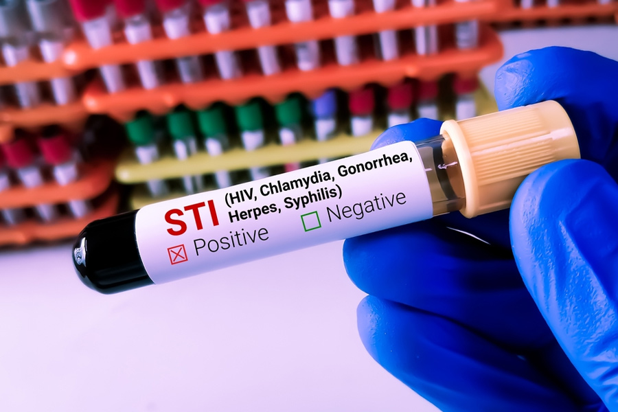 sti for couples safe sex