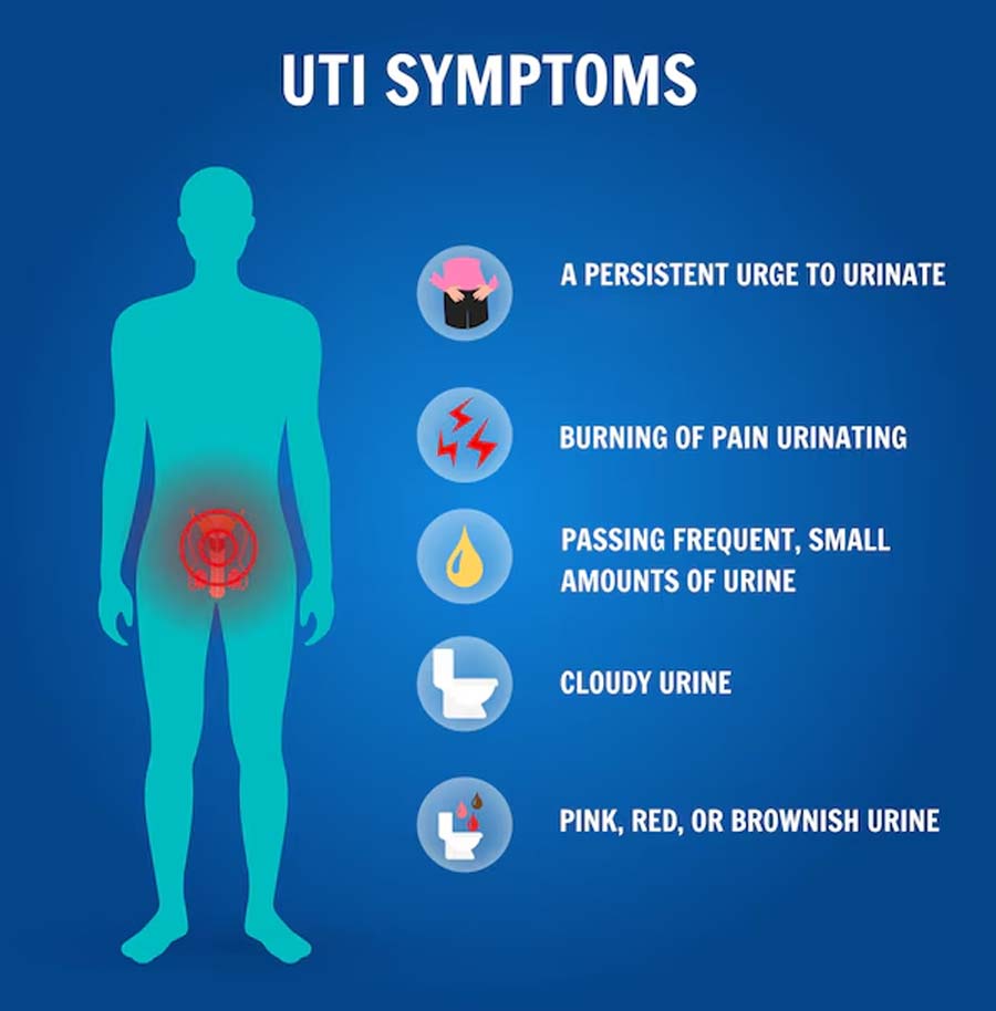 uti in summer symptoms