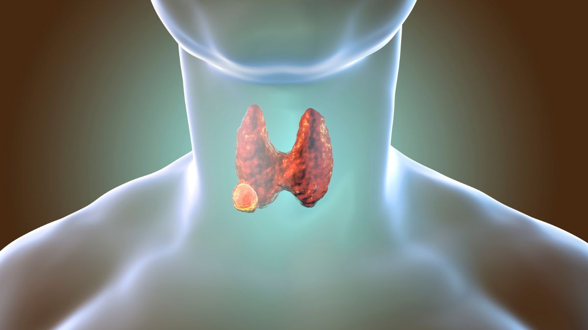 Neuroendocrine Tumours: What Are They, Why Do They Often Go Unnoticed, And More, As Per Expert