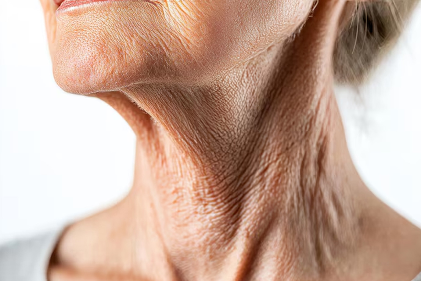 Why Do Neck Lines Appear