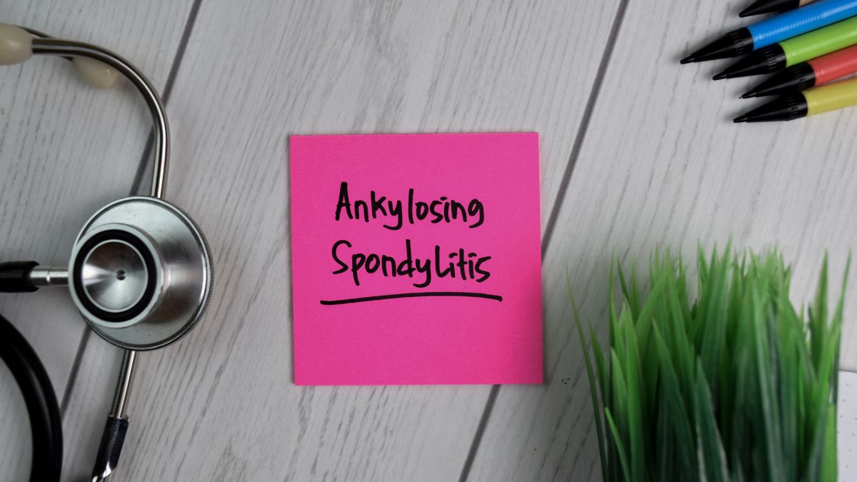 Ankylosing Spondylitis