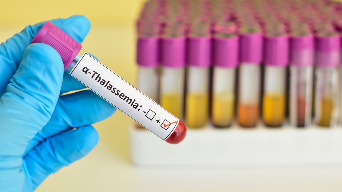 Thalassemia Screening