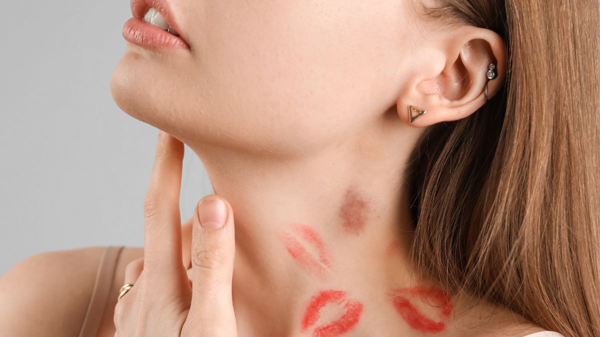 Love Bite On The Neck? 5 Hacks To Cover Them And Avoid Inviting