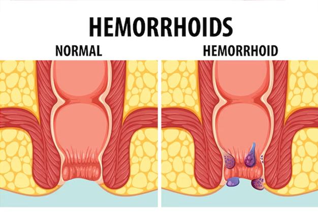 what happens if you dont poop for days