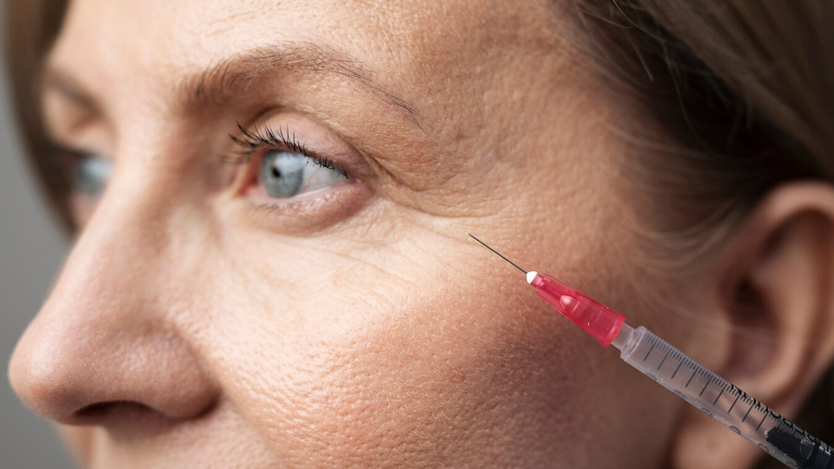 baby botox procedure