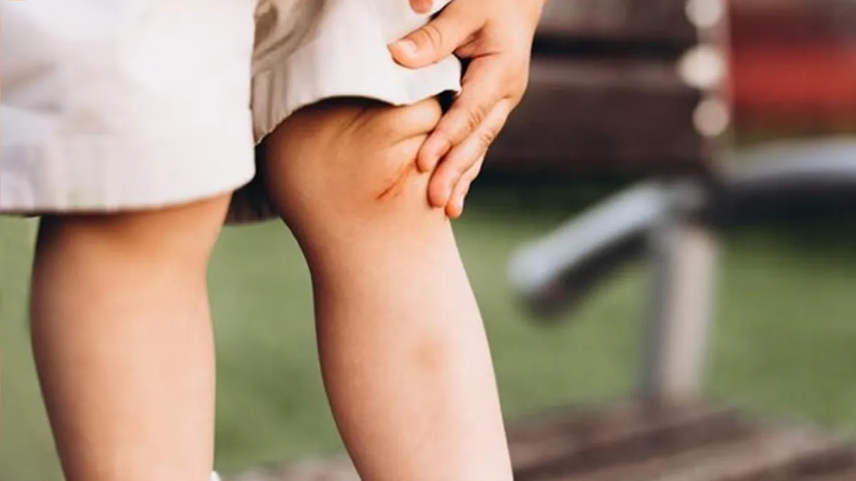 Can children really get arthritis