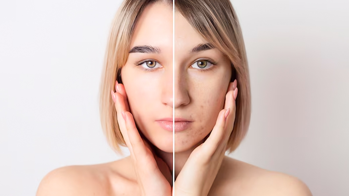 Sunburn, Tanning And Pigmentation: How To Protect Your Skin During Peak Summer