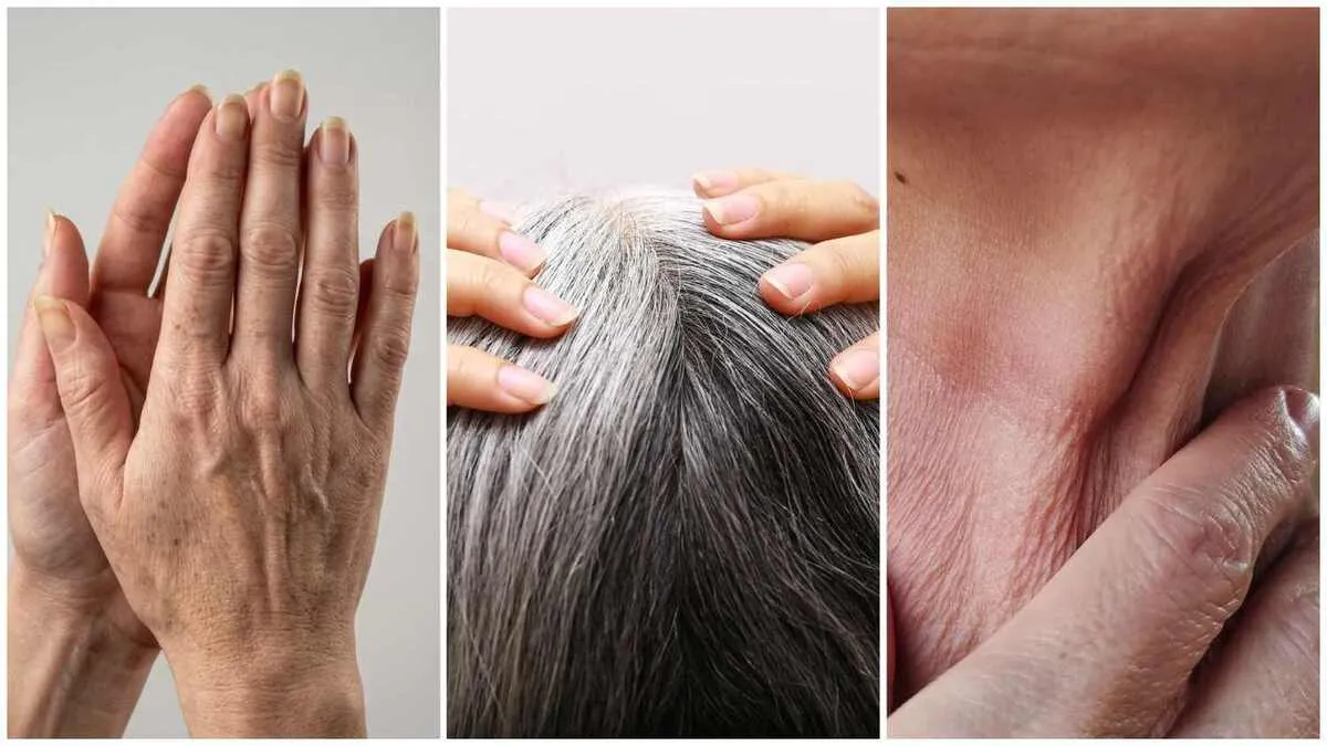 6 Signs of Ageing