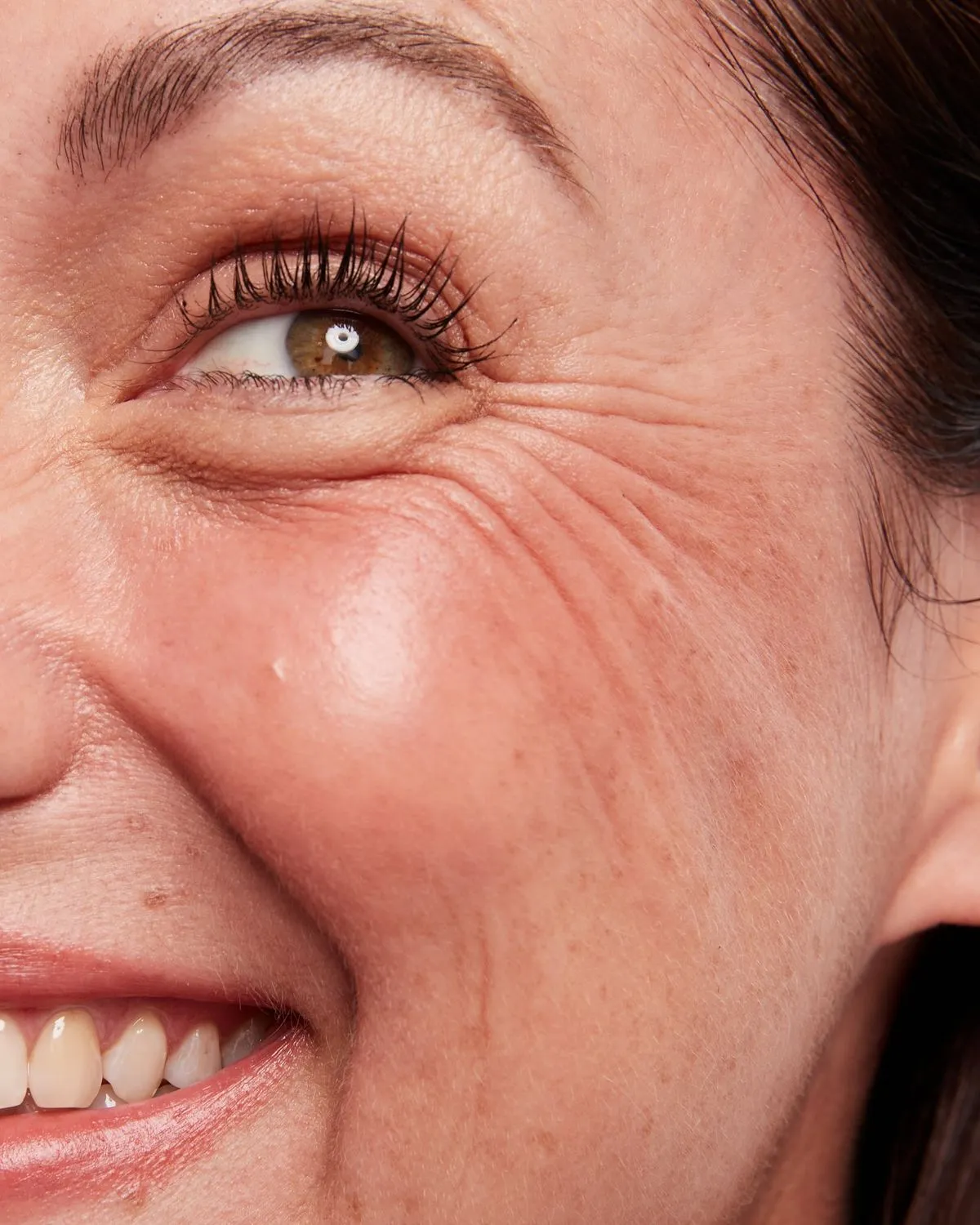 Eye ageing