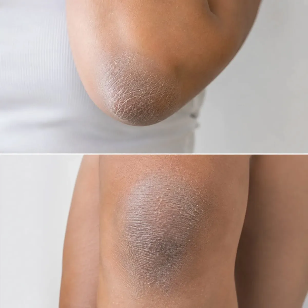 knee elbow