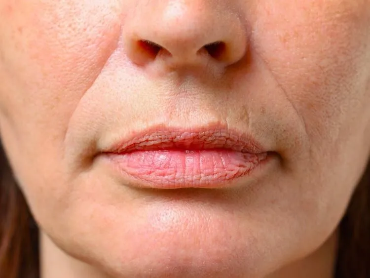 lips ageing