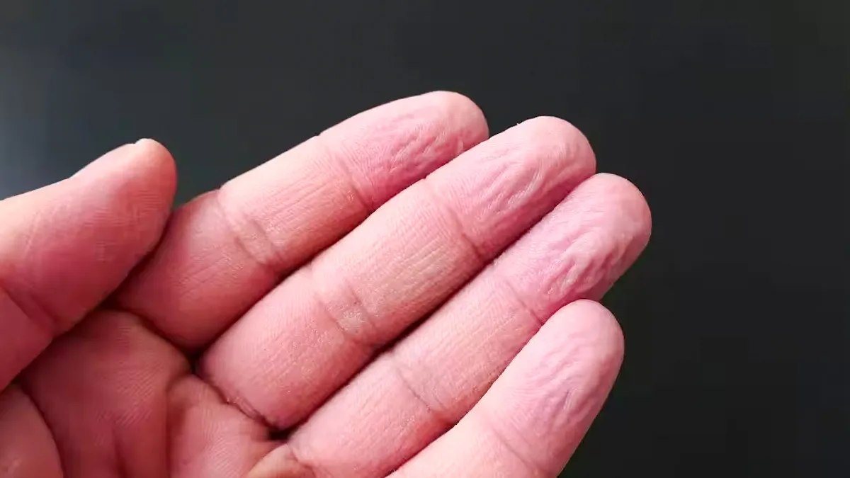 Why Do Fingers Go Wrinkly In Water? It’s Not Absorption—Here Is The Evolutionary Science