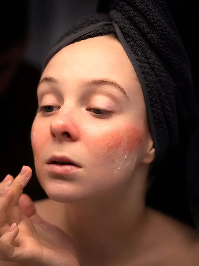 Skin Irritation