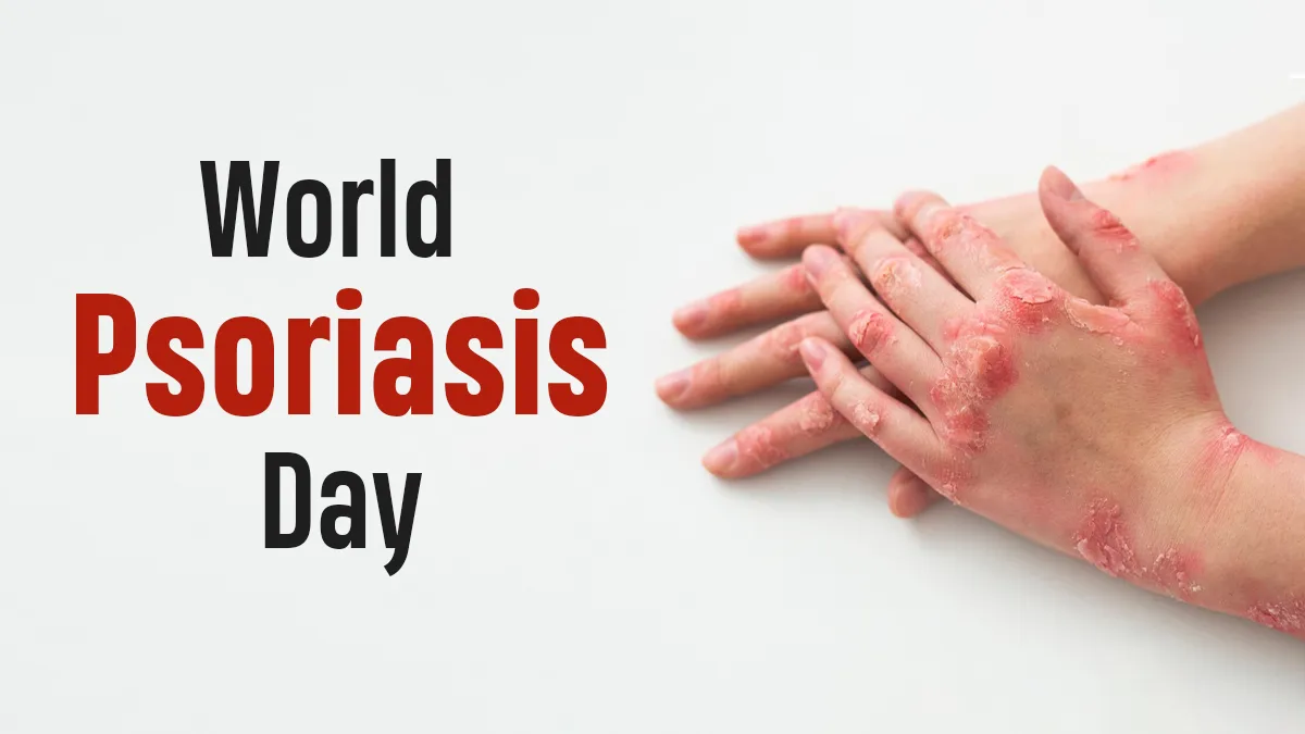 World Psoriasis Day