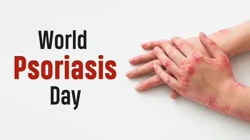 World Psoriasis Day