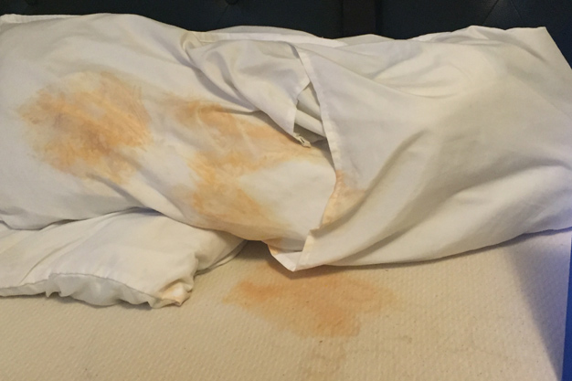 how to remove dirt stains from rajai