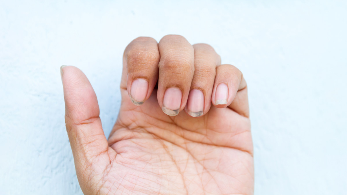 ways-to-clean-yellow-and-dirty-nails