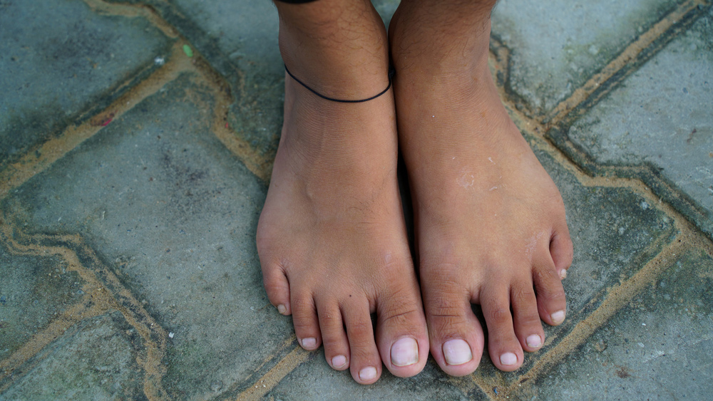 what happens if wear black thread on leg