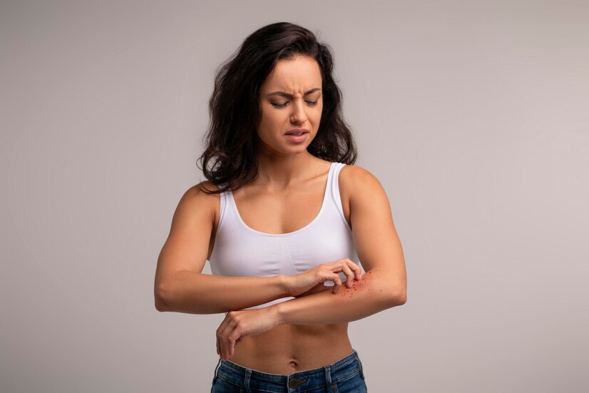 get rid of itching after taking bath