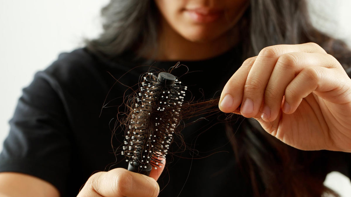 hair fall