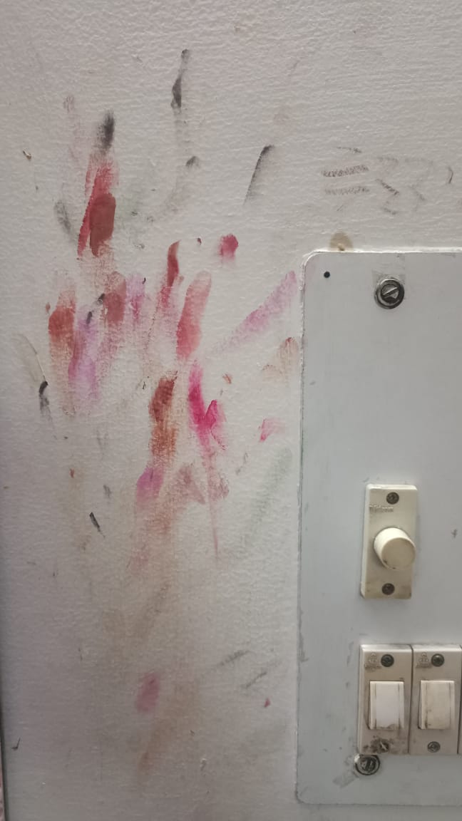 remove lipstick stains