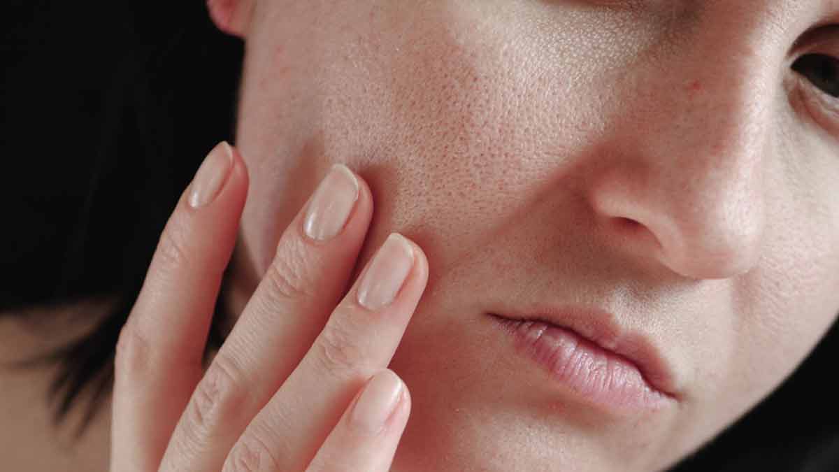 skin open pores