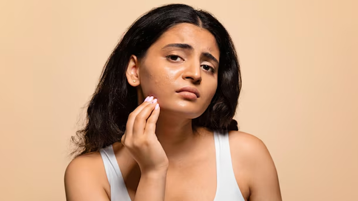 dead skin solution (2)