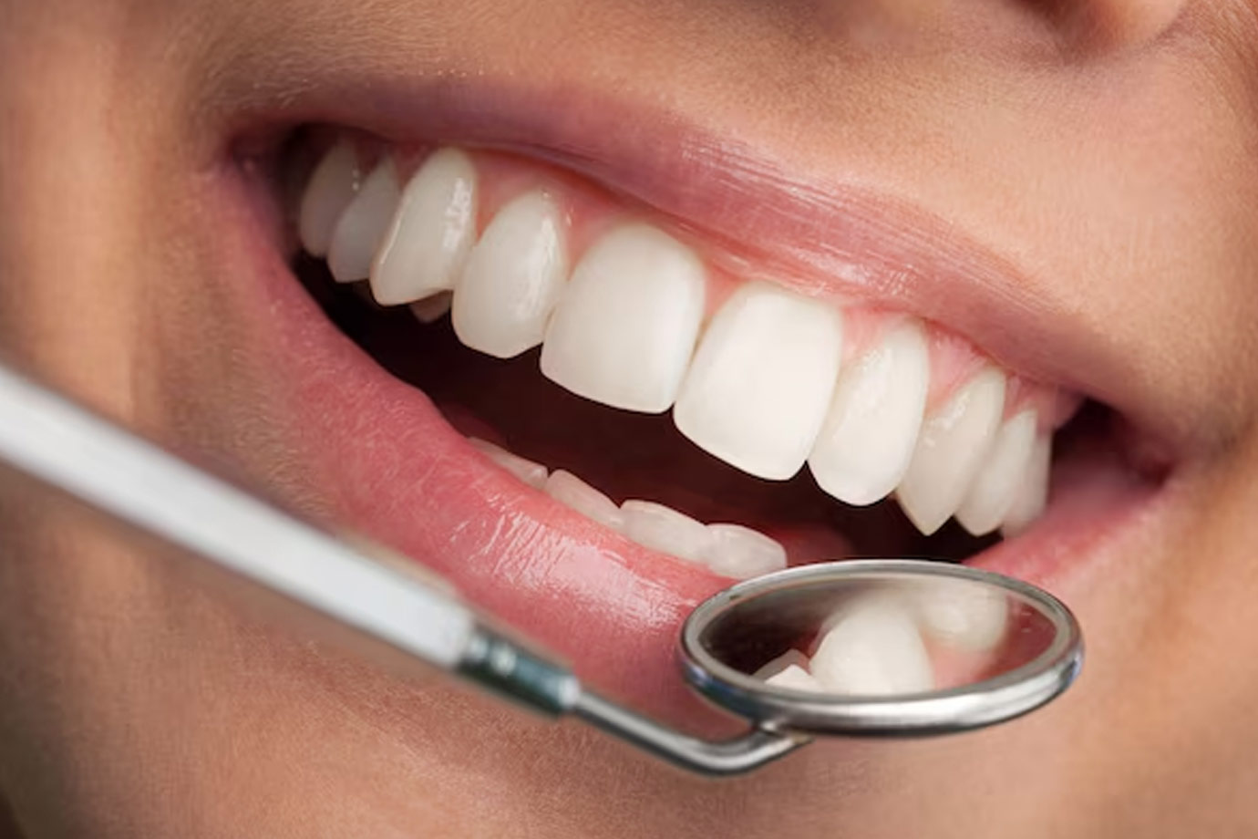 What is the best homemade teeth whitening