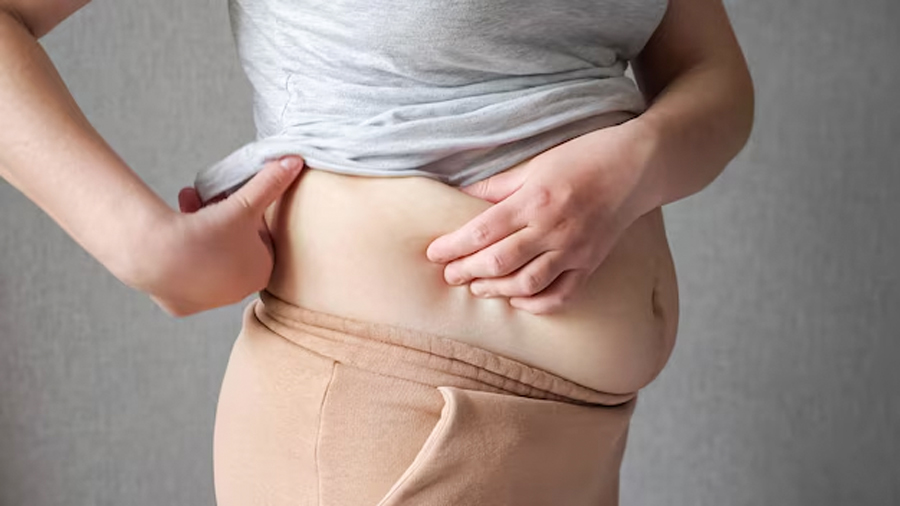 reason of belly fat