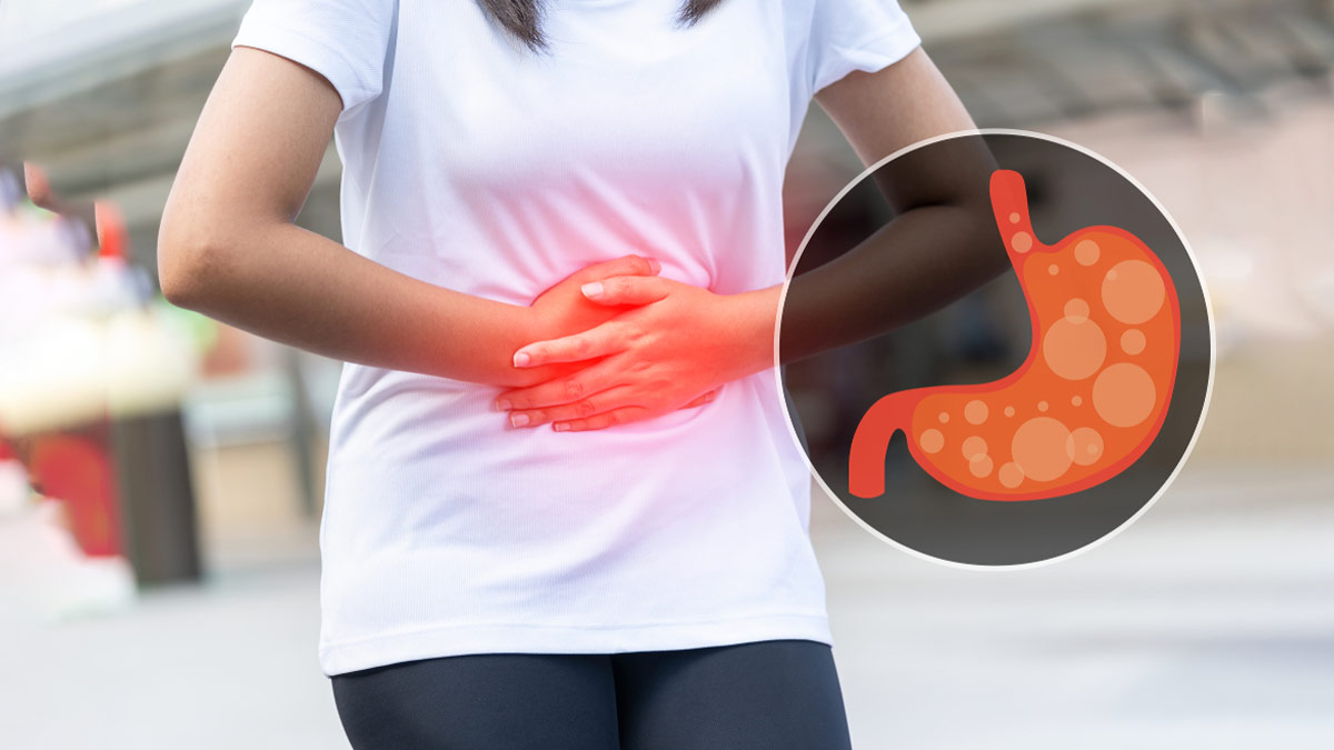 how to cure acidity in women