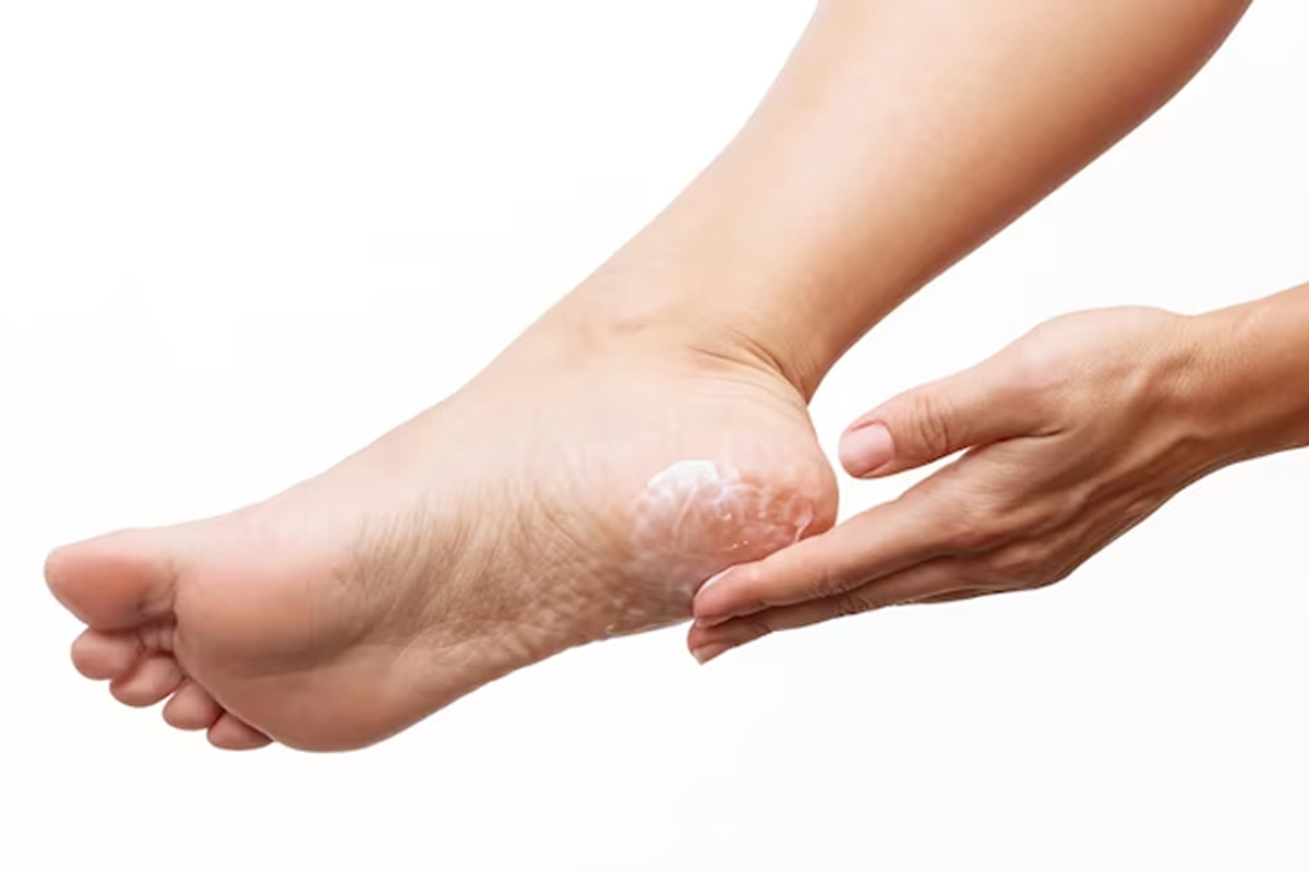 use wax and oil for cracked feet