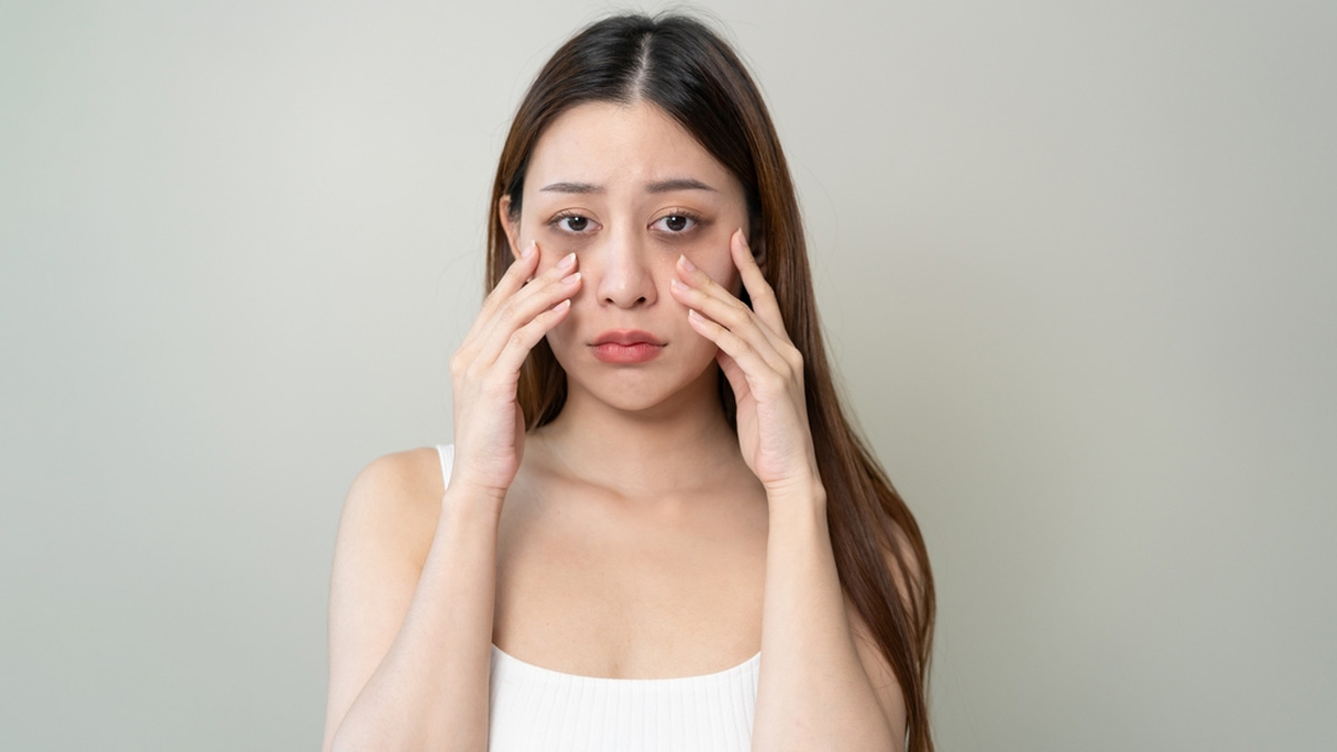 dark circles and iron deficienct
