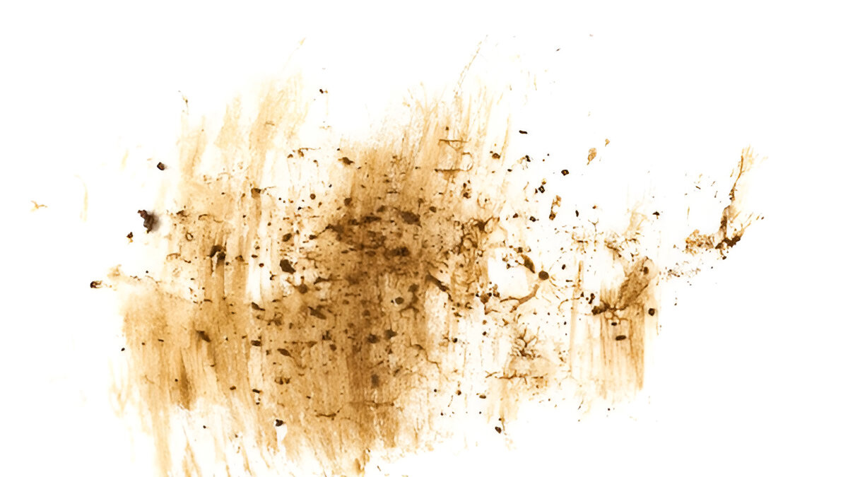 What is the best stain remover for white walls