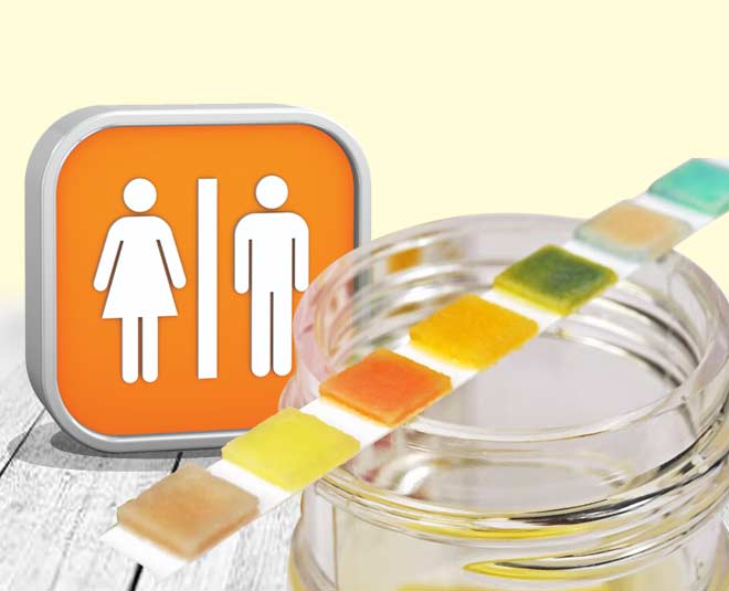 urine colour symptoms