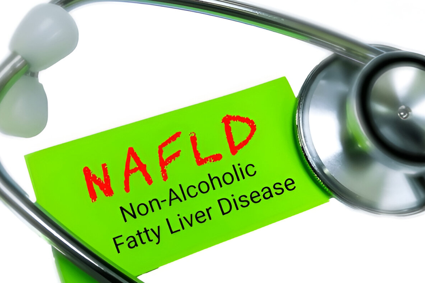 foods to avoid with fatty liver nafld