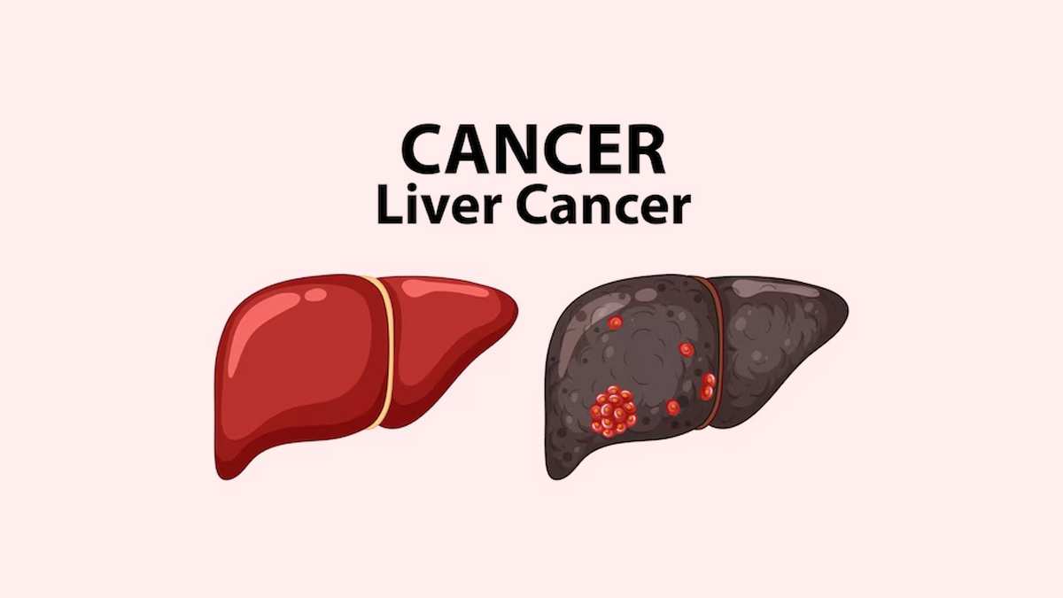is fatigue and no appetite a sign of liver cancer