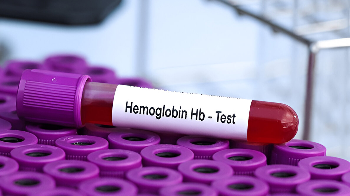 what to do when hemoglobin is low
